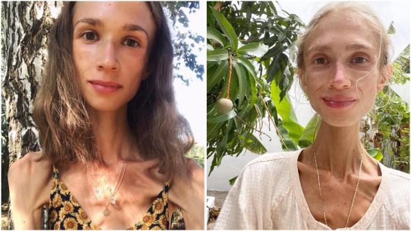 Bule Polandia Ditemukan Meninggal di Bali Usai Menjalani Diet Ekstrem