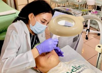 Tips Menghilangkan Flek Hitam Secara Medis dan Perawatan Efektif yang Aman