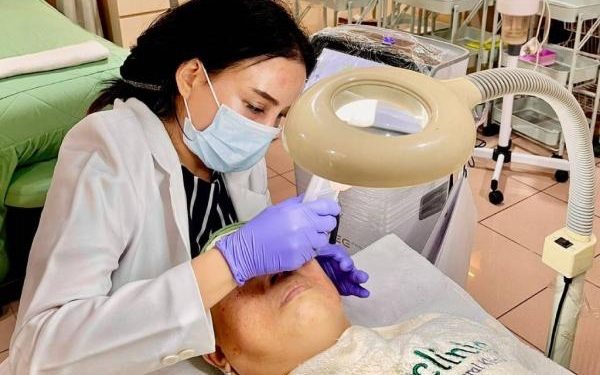 Tips Menghilangkan Flek Hitam Secara Medis dan Perawatan Efektif yang Aman